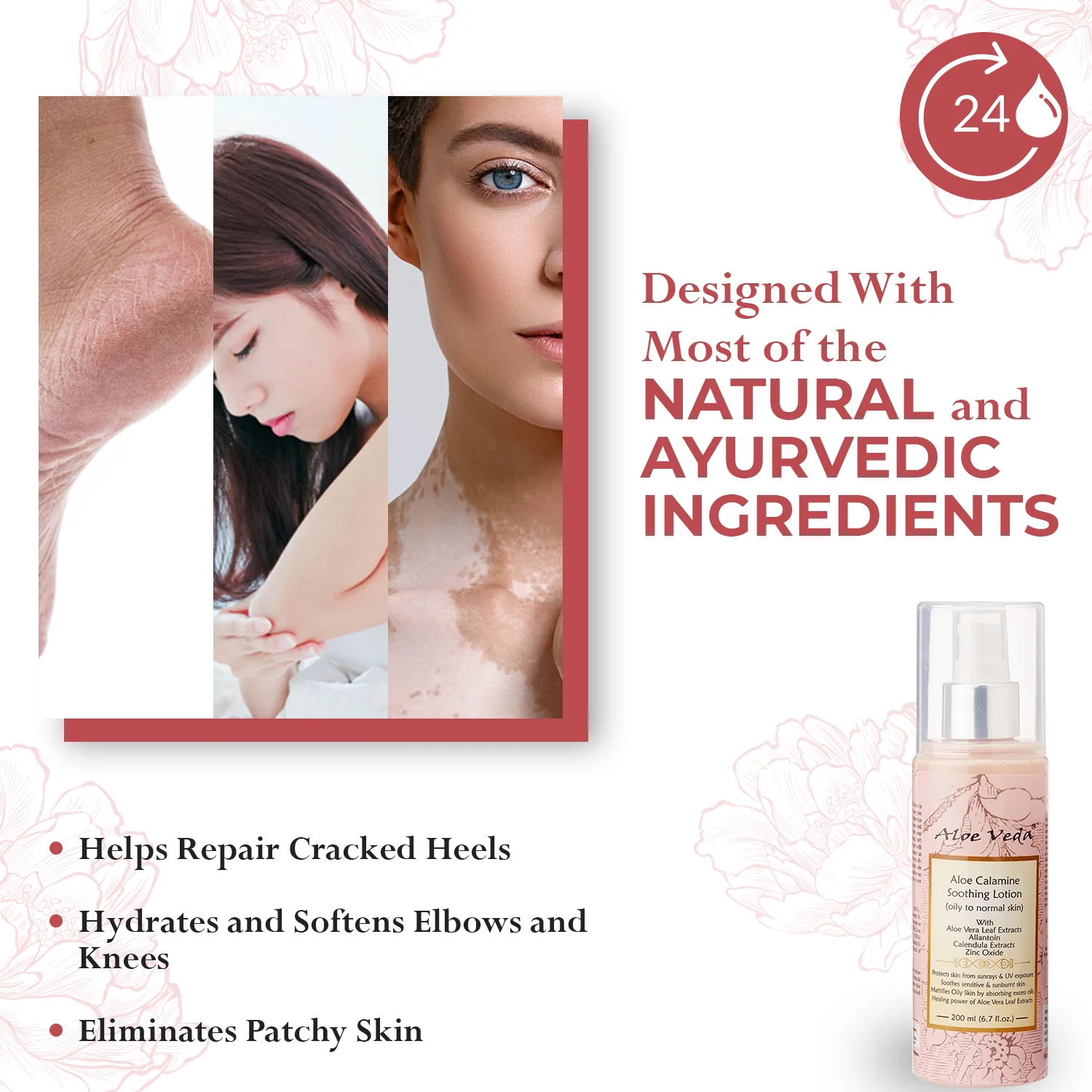 Aloe Veda Calamine Calming Body Lotion Skin Lotion with Calamine and Aloe Vera, 200ml