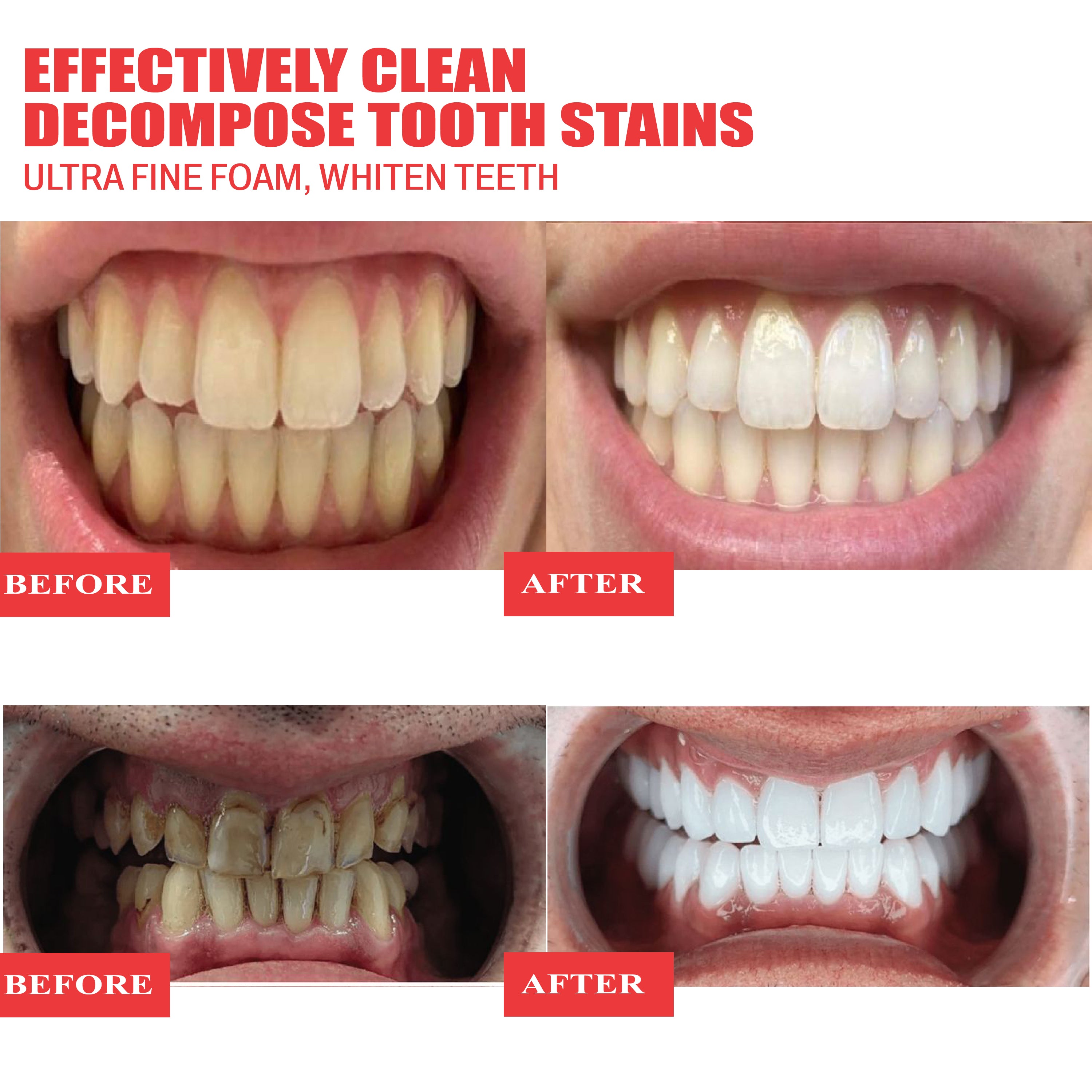 Ivycare Toothpaste, Gel- Cream Blueberry Bright(NEW)